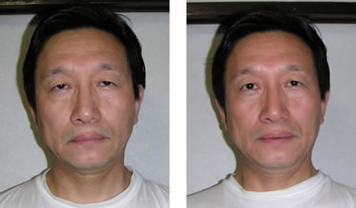 Before and After Qigong Beauty Rejuvenation Energy Facelift